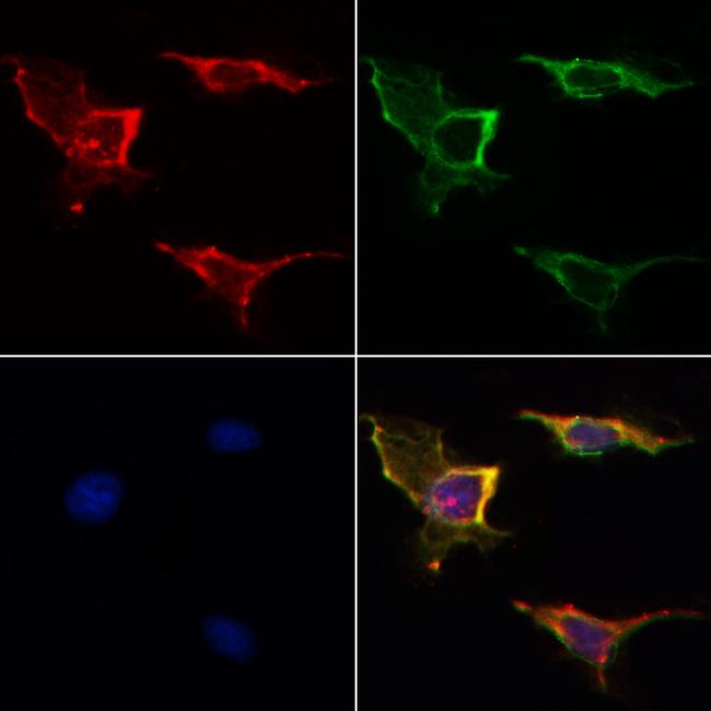 VDAC2 Antibody in Immunocytochemistry (ICC/IF)