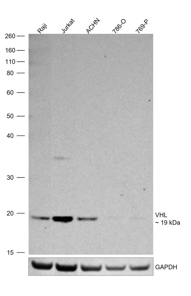 VHL Antibody in Western Blot (WB)