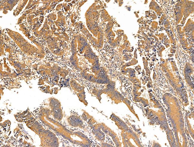 ZNF281 Antibody in Immunohistochemistry (Paraffin) (IHC (P))