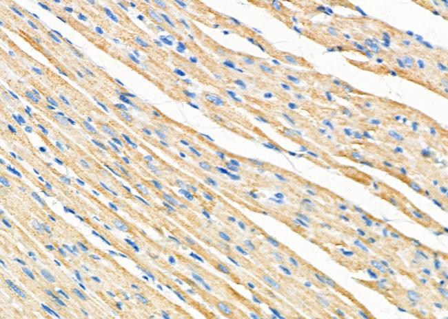 ZP2 Antibody in Immunohistochemistry (Paraffin) (IHC (P))