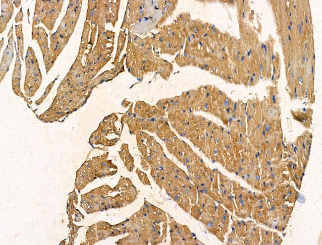 PHOSPHO1 Antibody in Immunohistochemistry (Paraffin) (IHC (P))