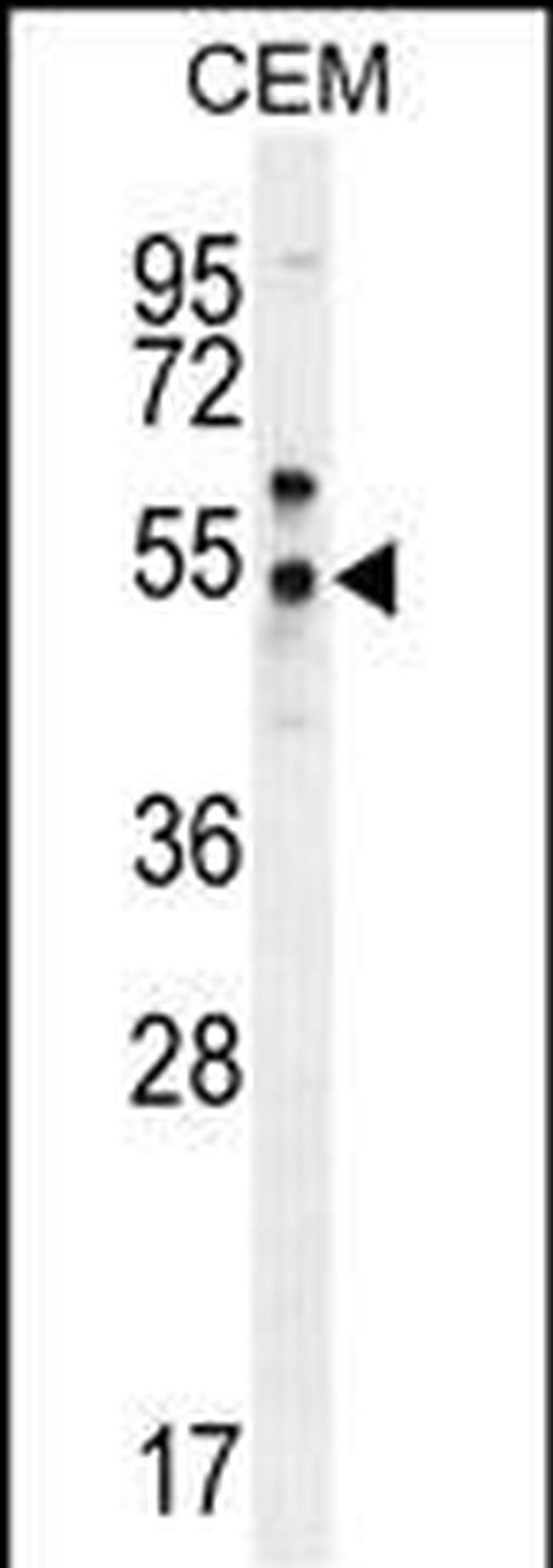 PSMAL Antibody in Western Blot (WB)