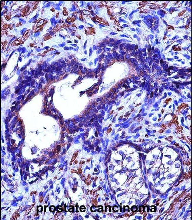 ACTG2 Antibody in Immunohistochemistry (Paraffin) (IHC (P))