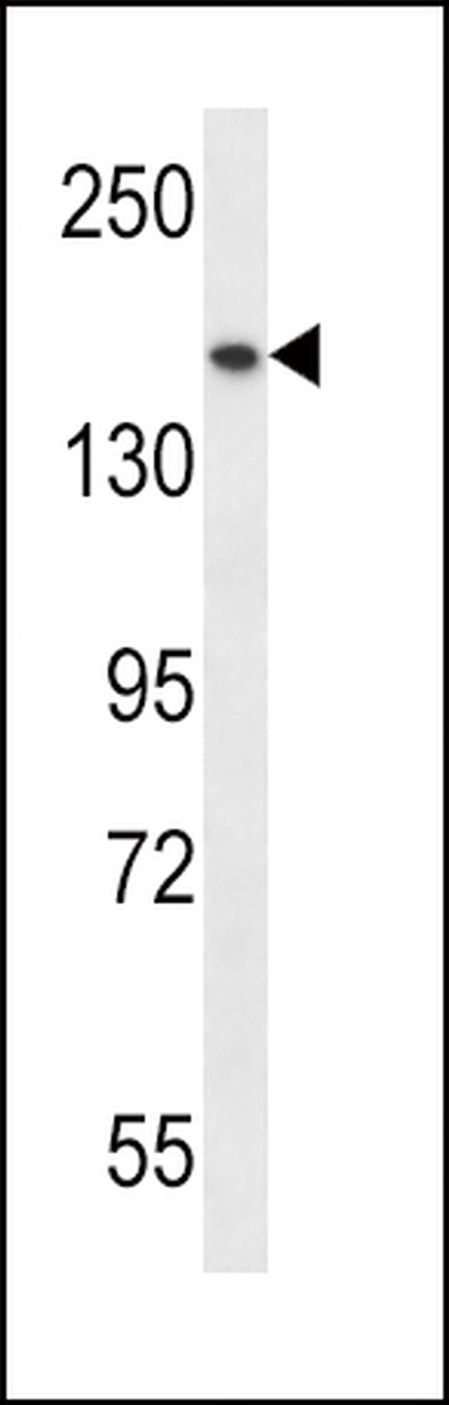 SMC1 Antibody in Western Blot (WB)