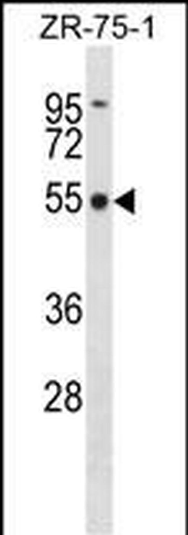 FBXO5 Antibody in Western Blot (WB)