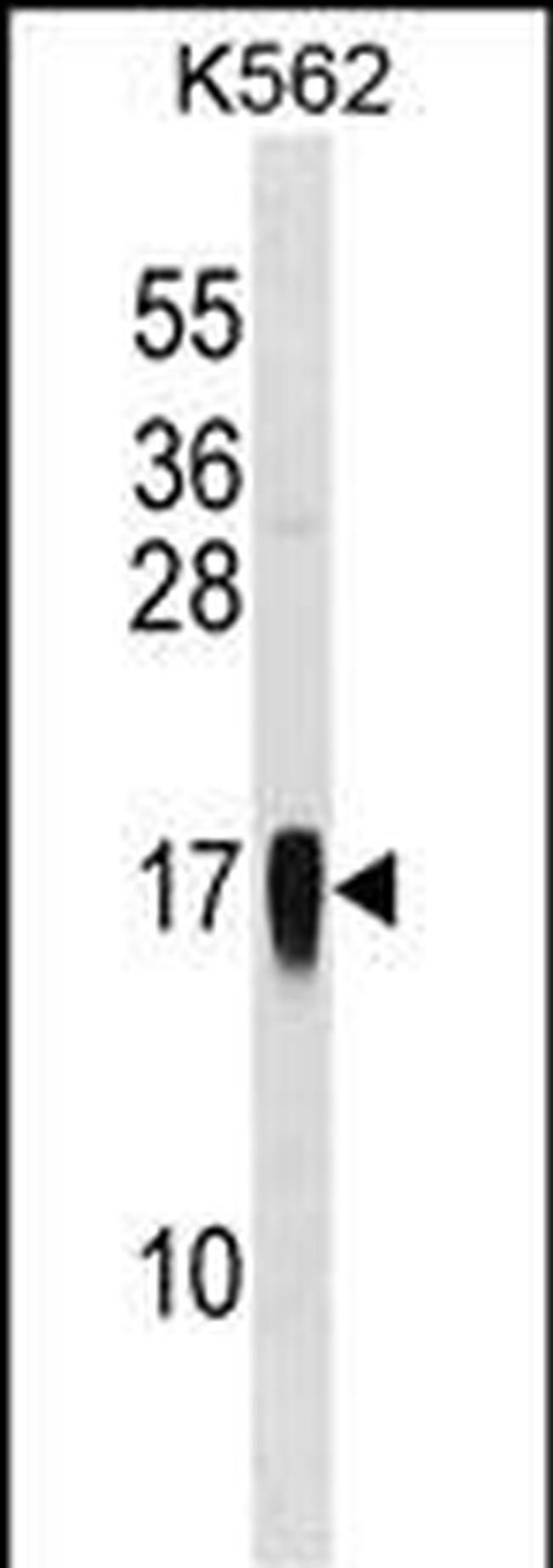 MCP-3 Antibody in Western Blot (WB)