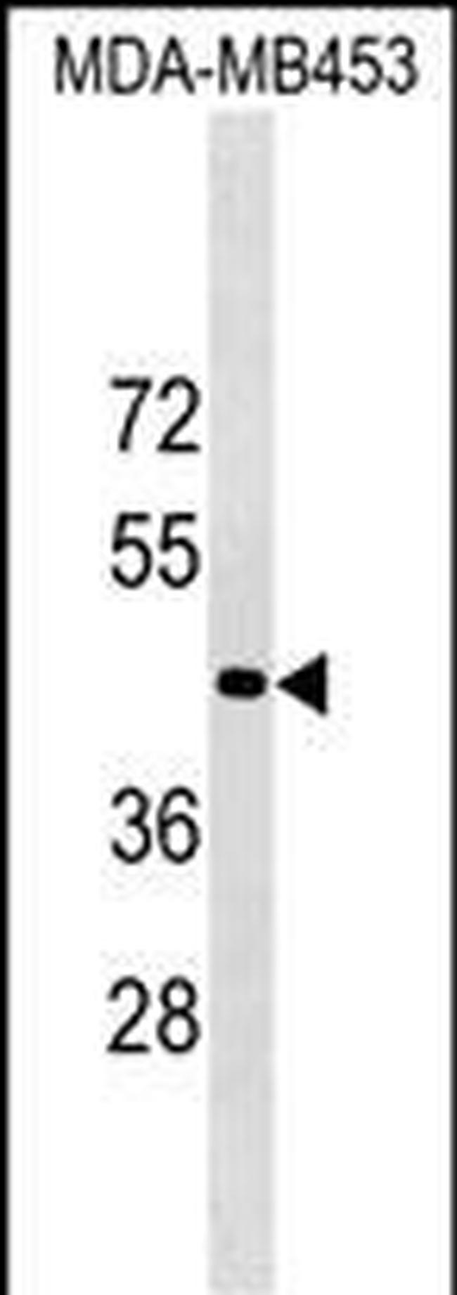 OR1N2 Antibody in Western Blot (WB)