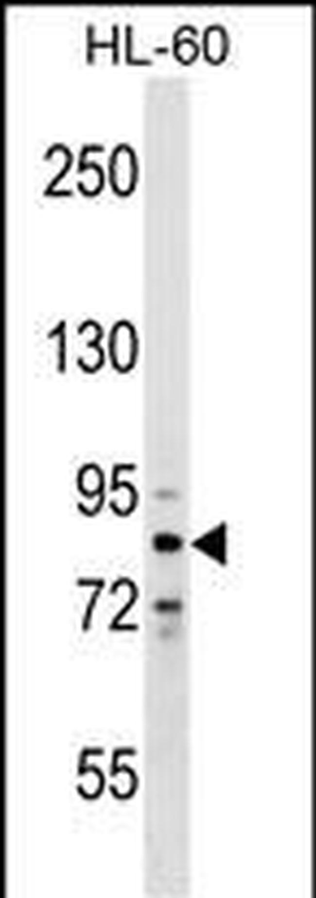 ZNF224 Antibody in Western Blot (WB)