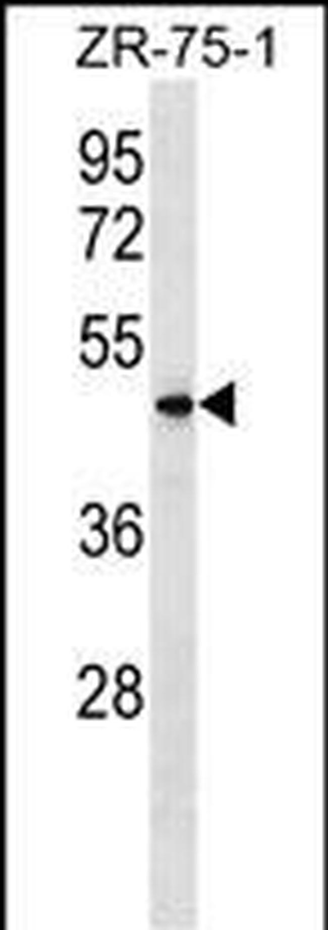 VN1R5 Antibody in Western Blot (WB)