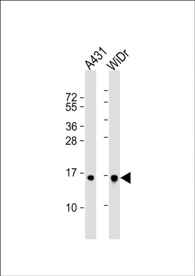 Histone H2B Antibody in Western Blot (WB)