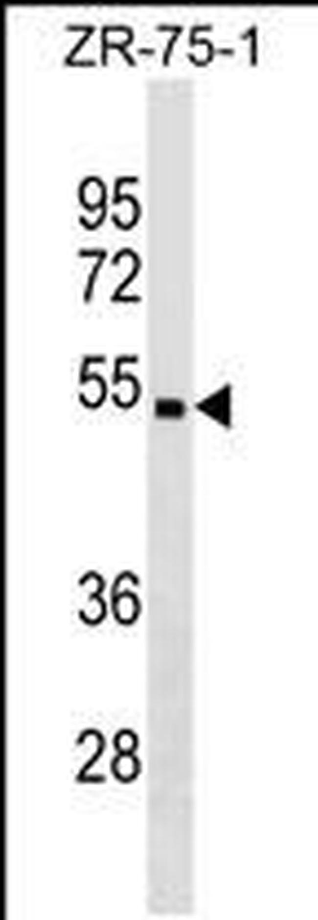 CHST5 Antibody in Western Blot (WB)