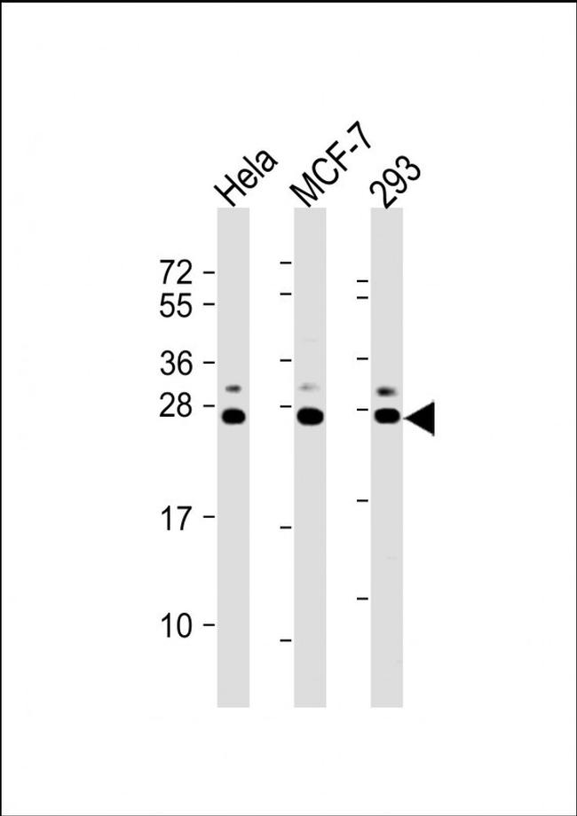 KDEL Antibody in Western Blot (WB)