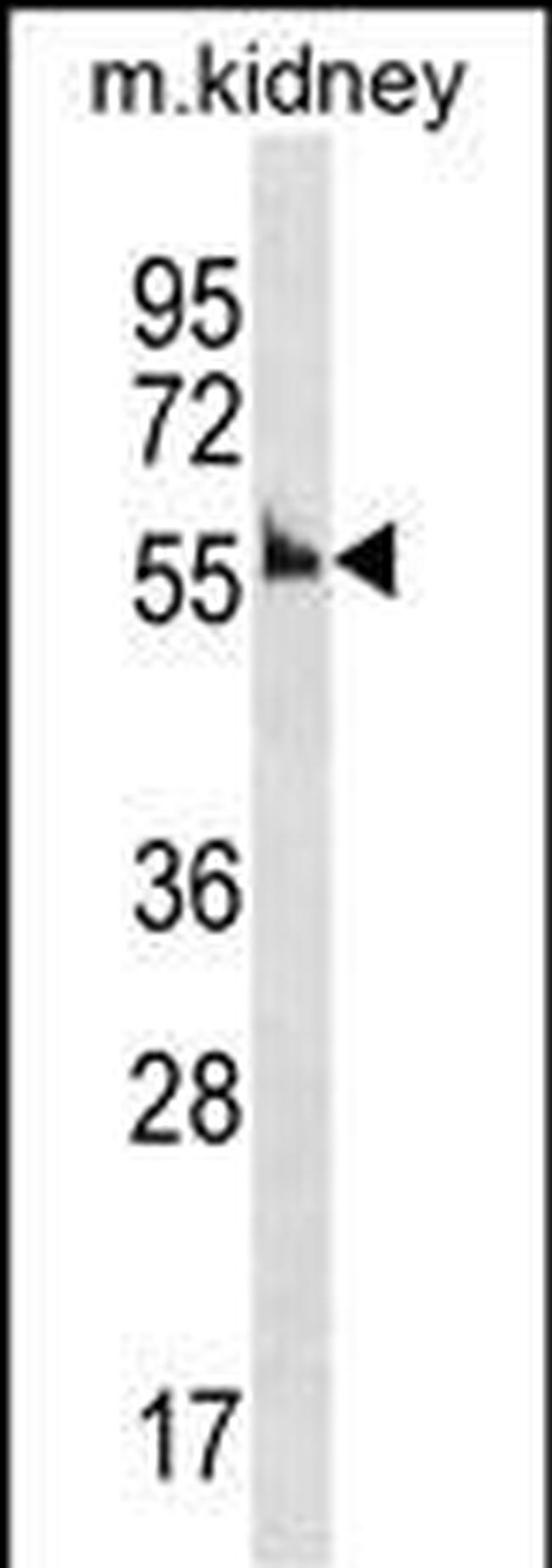 Cyclin A1 Antibody in Western Blot (WB)