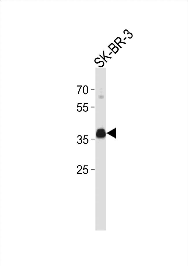 Estrogen Receptor alpha Antibody in Western Blot (WB)