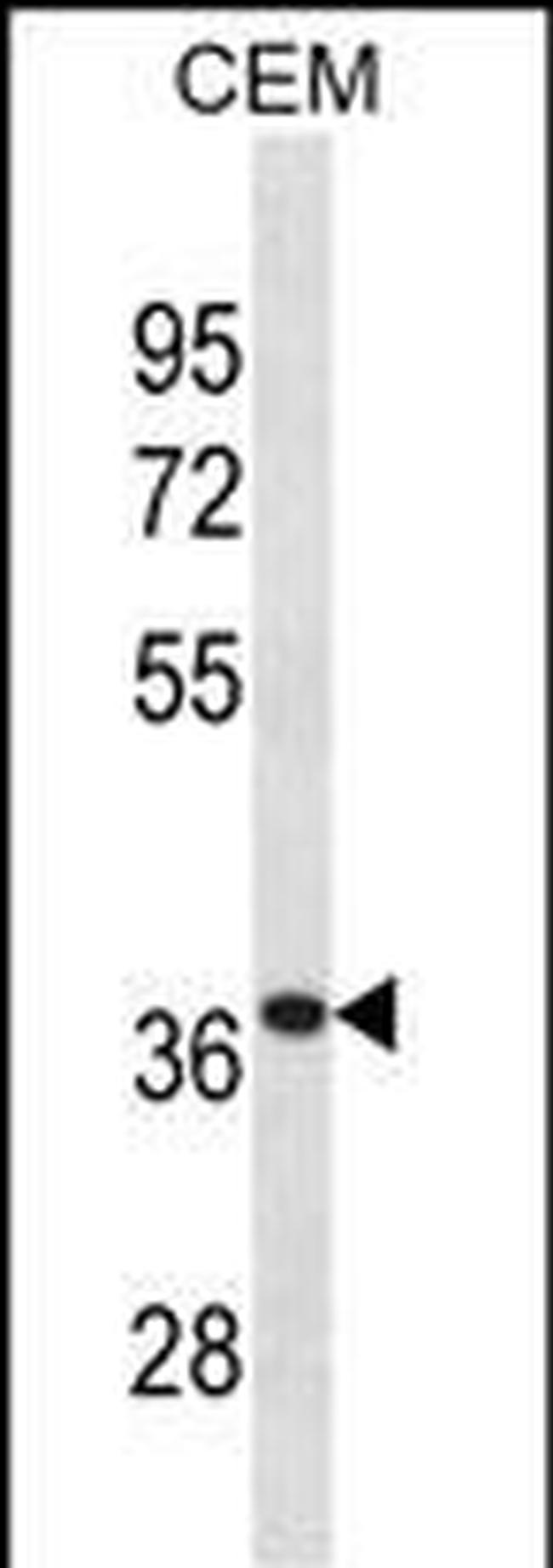 alpha TTP Antibody in Western Blot (WB)