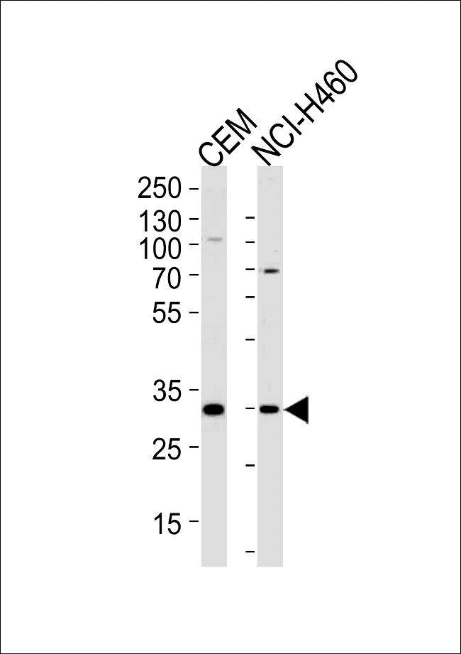 Macro H2A.2 Antibody in Western Blot (WB)