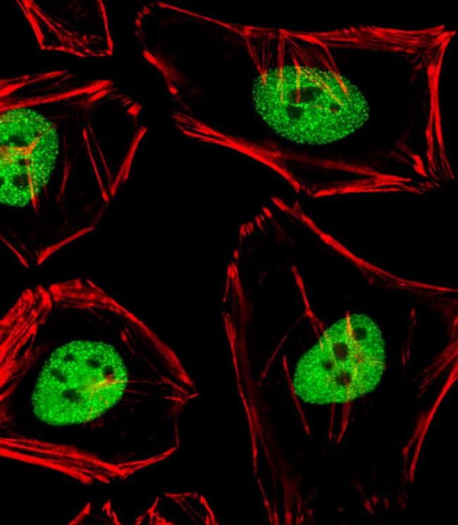 ANAPC2 Antibody in Immunocytochemistry (ICC/IF)