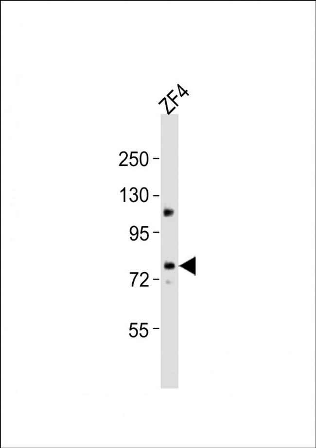 MTM1 Antibody in Western Blot (WB)