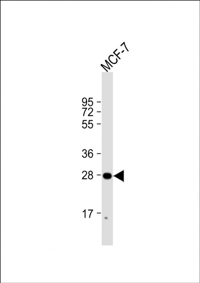 H1FNT Antibody in Western Blot (WB)