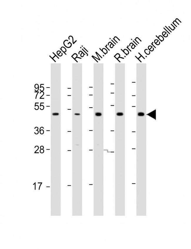 GNAS Antibody in Western Blot (WB)