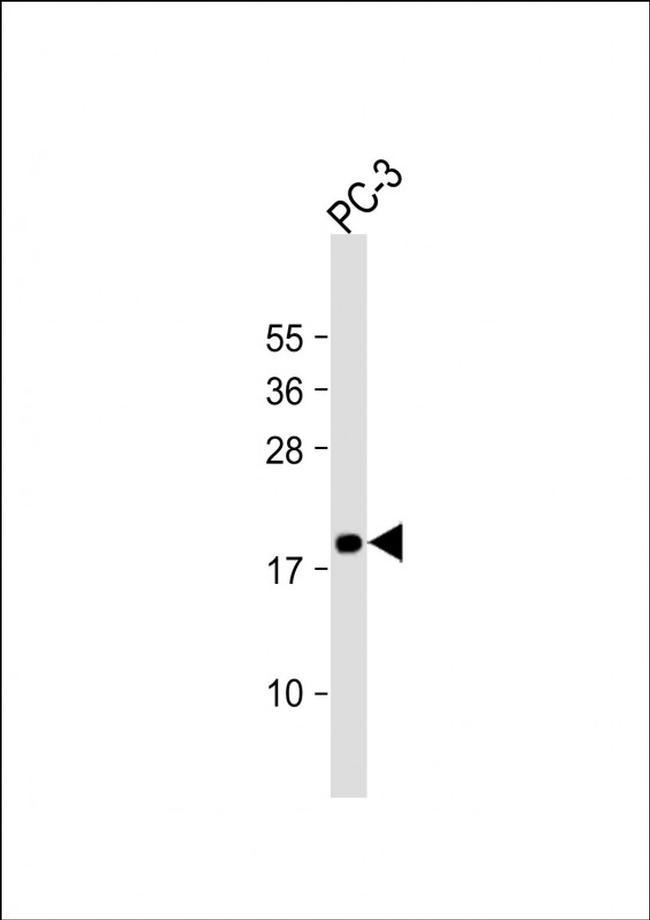 MEAF6 Antibody in Western Blot (WB)