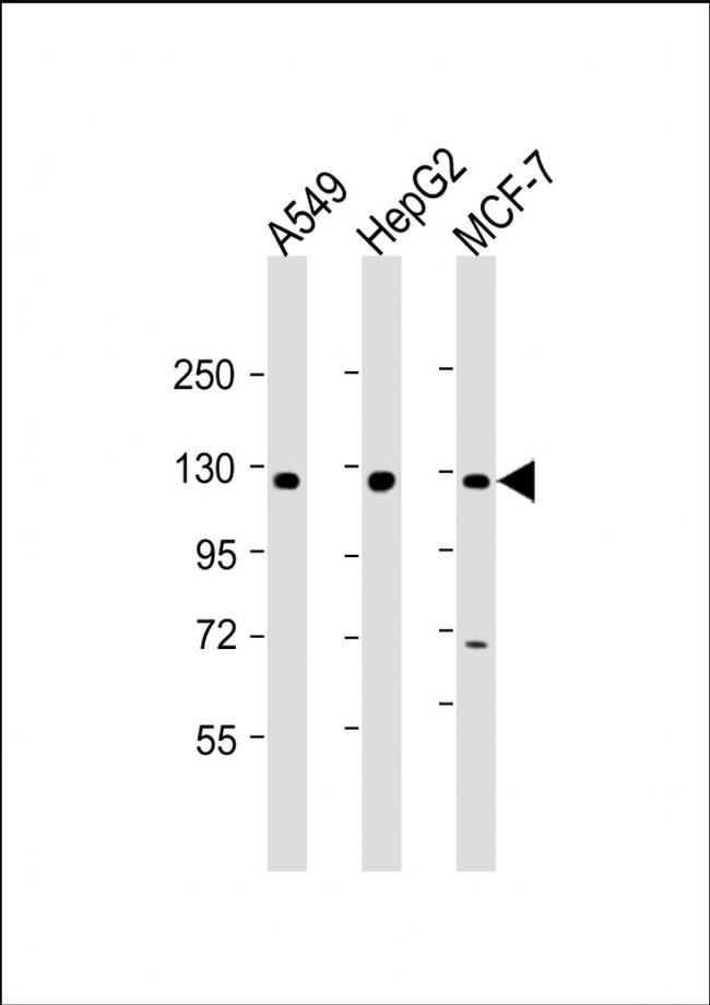 KLB Antibody in Western Blot (WB)