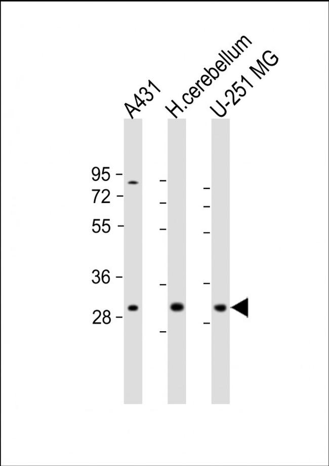 BCDIN3D Antibody in Western Blot (WB)