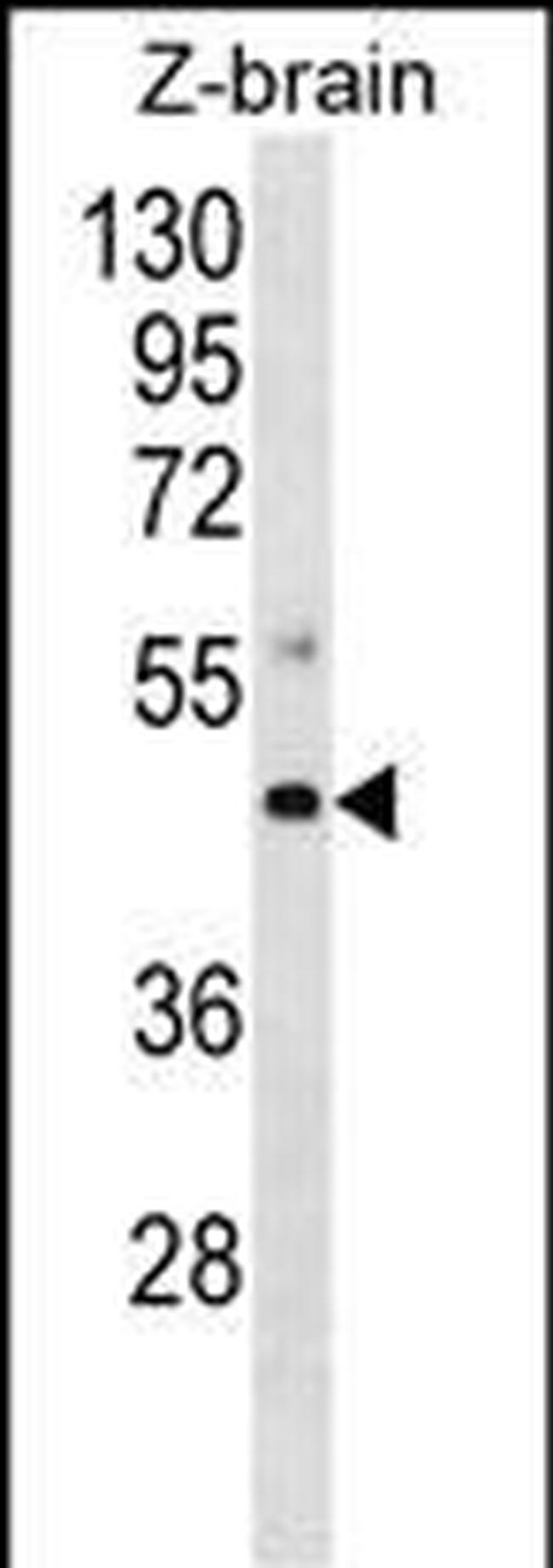 MAP2K4 Antibody in Western Blot (WB)