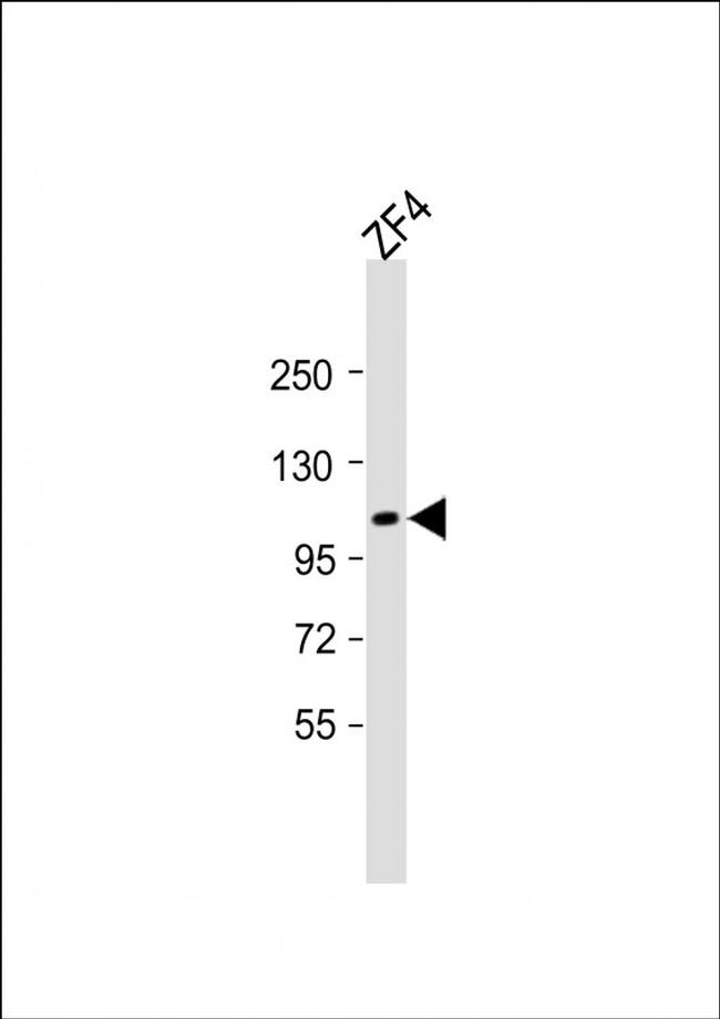 TEK Antibody in Western Blot (WB)