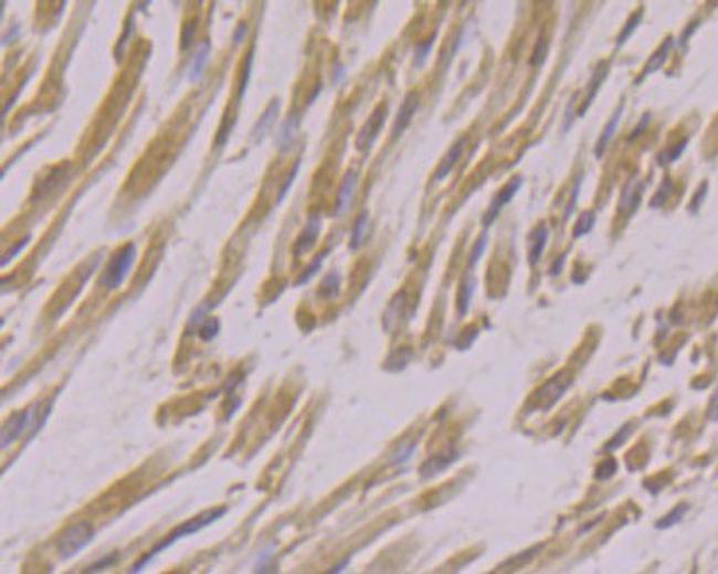 USP21 Antibody in Immunohistochemistry (Paraffin) (IHC (P))