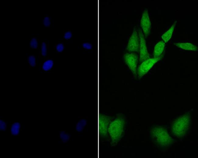 delta Catenin Antibody in Immunocytochemistry (ICC/IF)