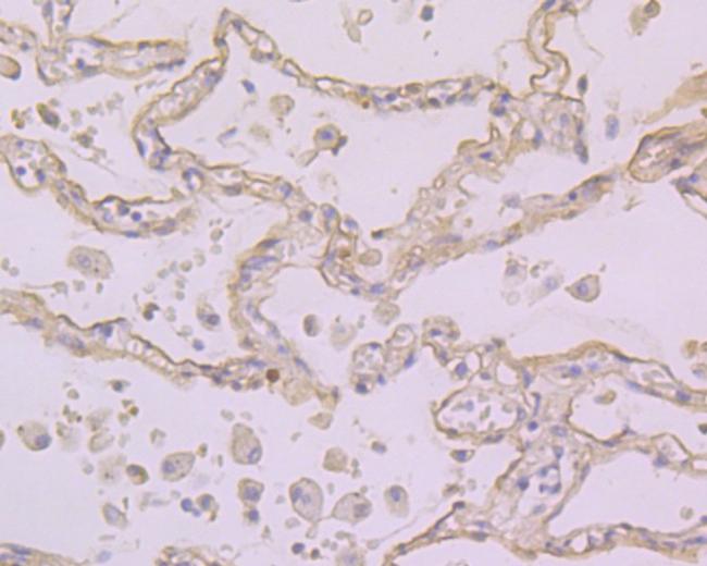 Folate Receptor alpha Antibody in Immunohistochemistry (Paraffin) (IHC (P))