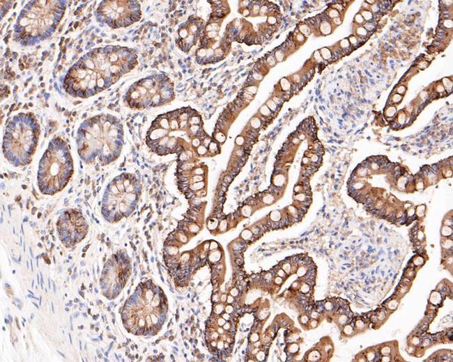 Cytokeratin 20 Antibody in Immunohistochemistry (Paraffin) (IHC (P))