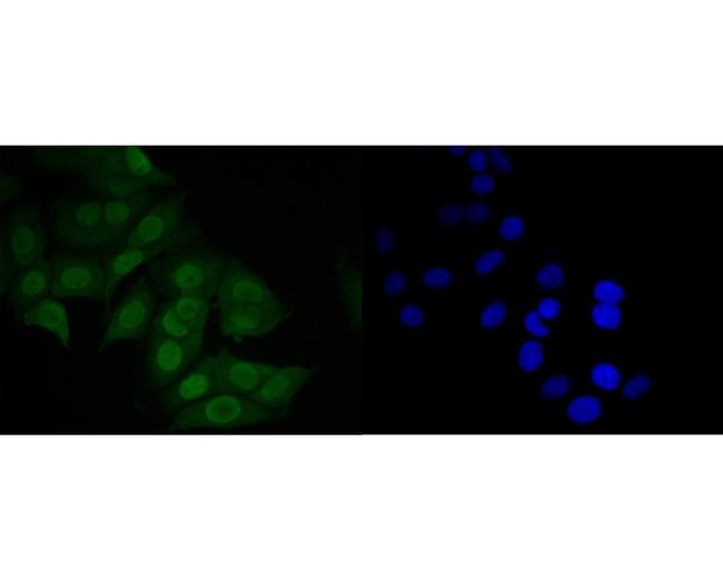 MDM2 Antibody in Immunocytochemistry (ICC/IF)