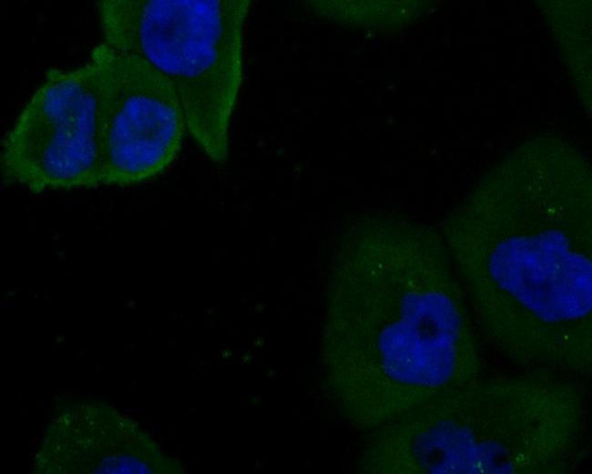 KV1.4 (KCNA4) Antibody in Immunocytochemistry (ICC/IF)