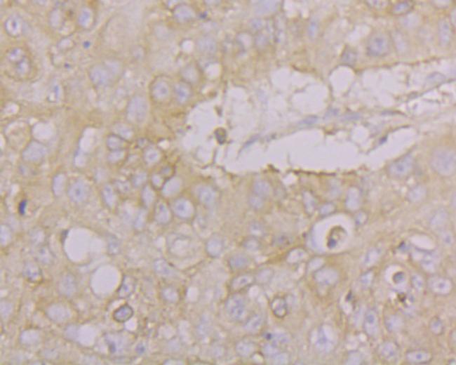 Drebrin Antibody in Immunohistochemistry (Paraffin) (IHC (P))