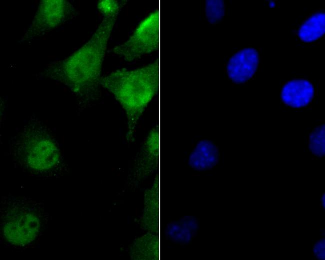 FEN1 Antibody in Immunocytochemistry (ICC/IF)