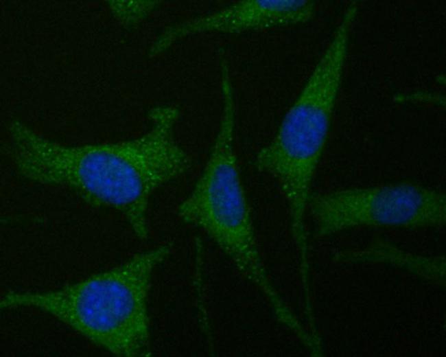 CDK5RAP3 Antibody in Immunocytochemistry (ICC/IF)