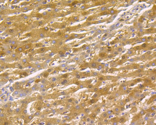 Thymidine Phosphorylase Antibody in Immunohistochemistry (Paraffin) (IHC (P))