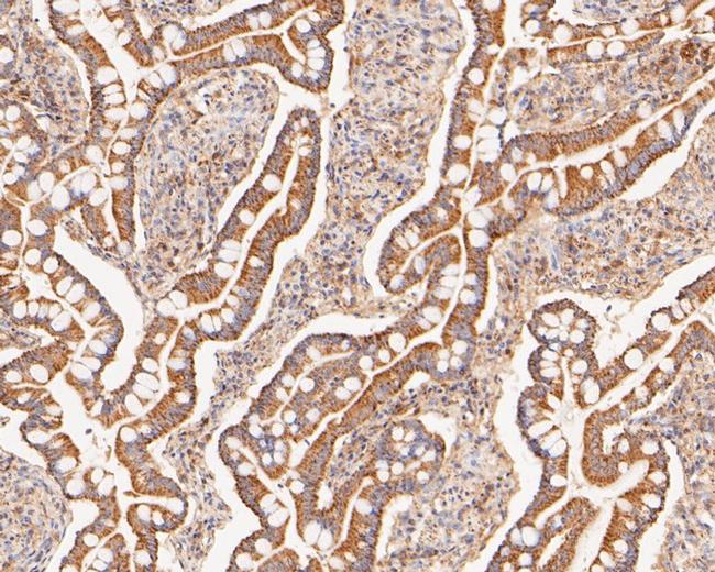 COX5B Antibody in Immunohistochemistry (Paraffin) (IHC (P))