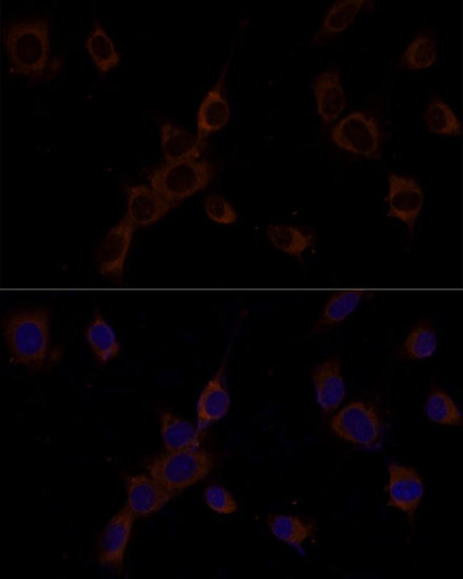 Caspase 9 Antibody in Immunocytochemistry (ICC/IF)