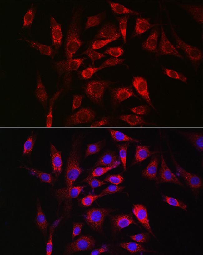 SOCS3 Antibody in Immunocytochemistry (ICC/IF)