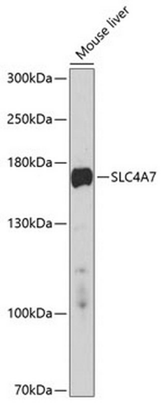 SLC4A7 Antibody in Western Blot (WB)