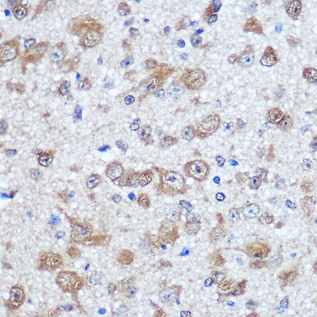 HuD Antibody in Immunohistochemistry (Paraffin) (IHC (P))