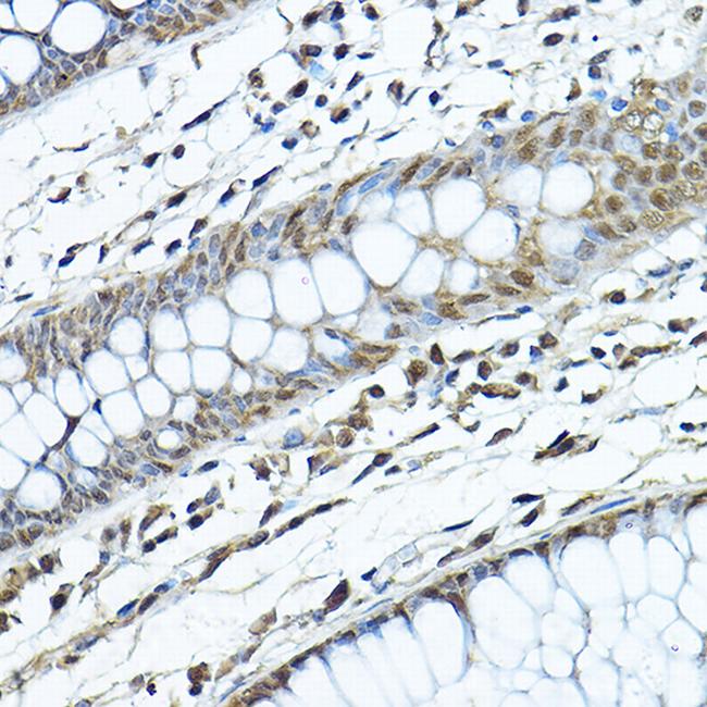 SIRT1 Antibody in Immunohistochemistry (Paraffin) (IHC (P))