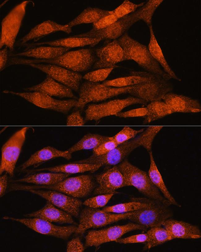 Bcl-3 Antibody in Immunocytochemistry (ICC/IF)