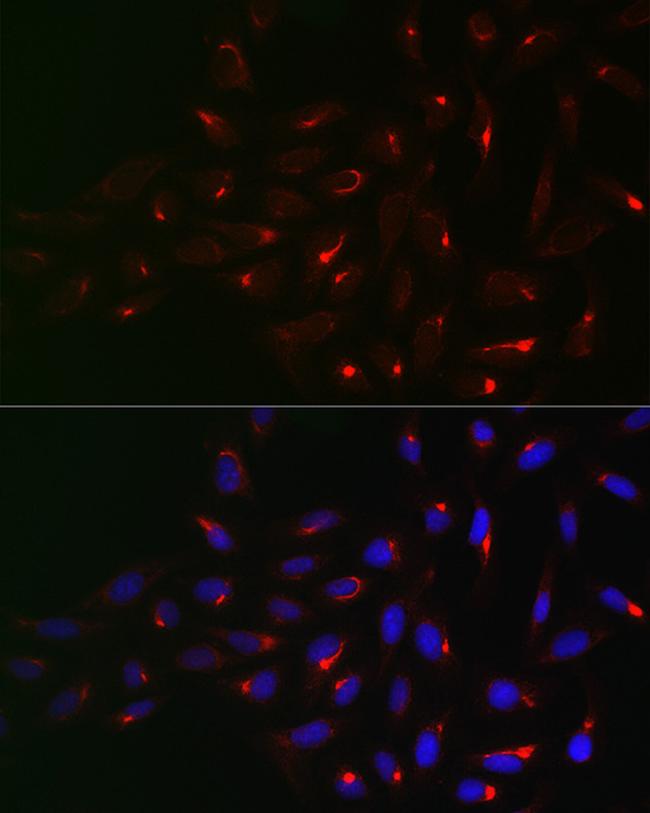 Vimentin Antibody in Immunocytochemistry (ICC/IF)