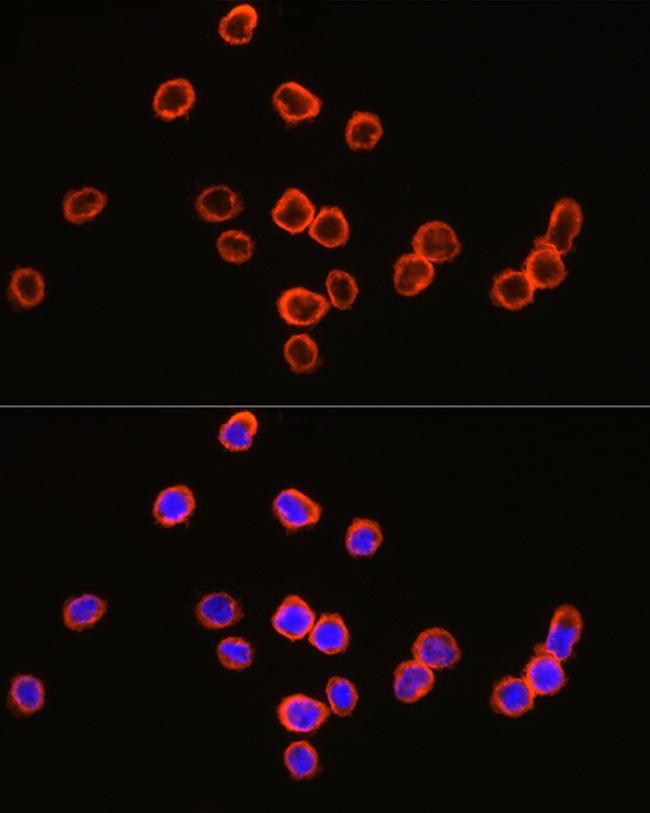 CD64 Antibody in Immunocytochemistry (ICC/IF)