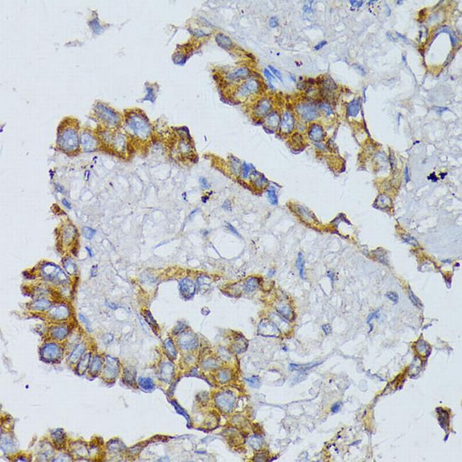 ACADL Antibody in Immunohistochemistry (Paraffin) (IHC (P))