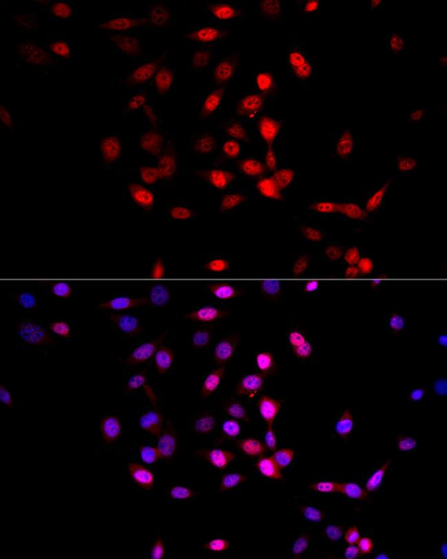 AMPK alpha-1,2 Antibody in Immunocytochemistry (ICC/IF)